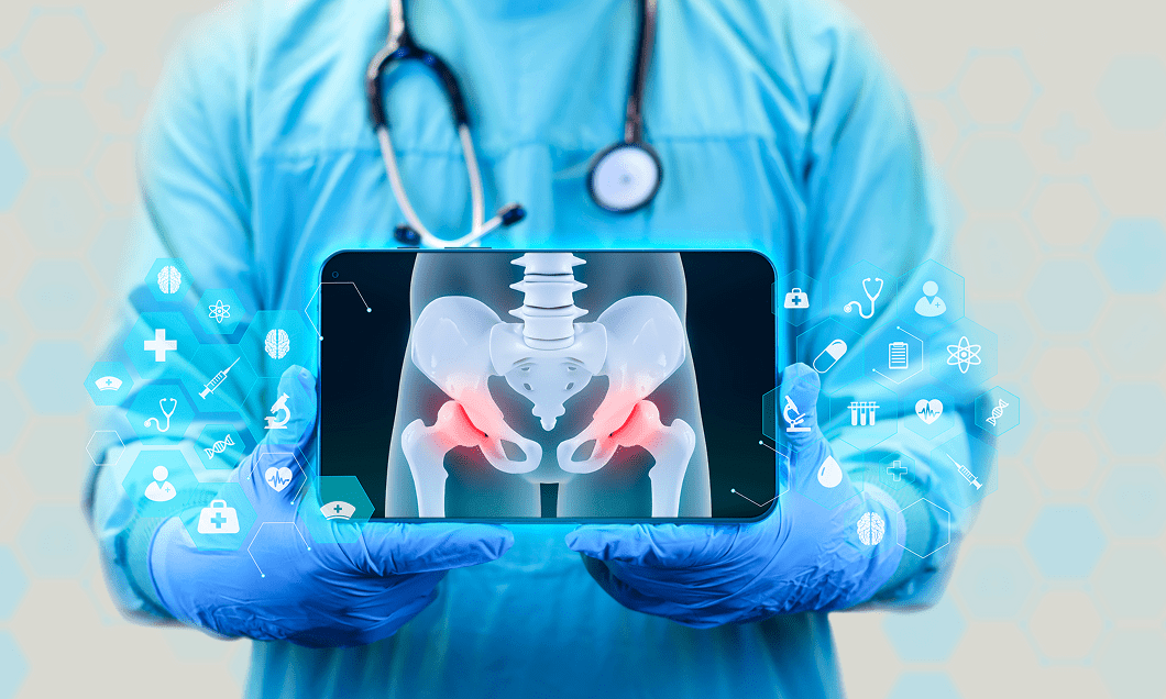 A doctor holding an X-ray that represents urgent hip replacement.